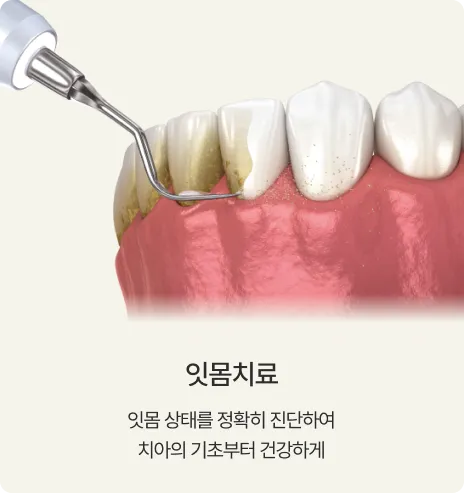 잇몸치료