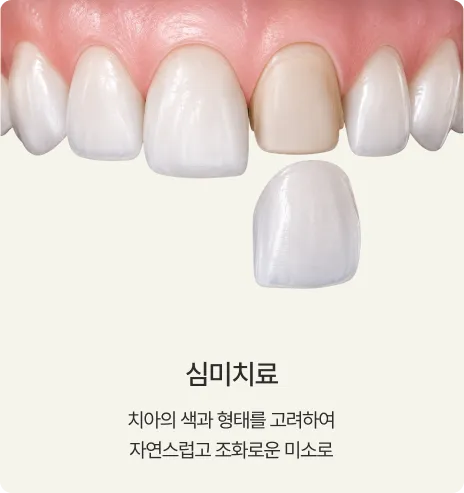 심미치료