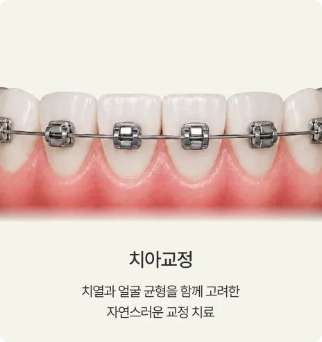치아교정